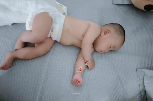 洛阳宝宝头上长痱子